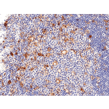 Immunohistochemistry - Anti-CD25 Antibody [RM418] (A121488) - Antibodies.com