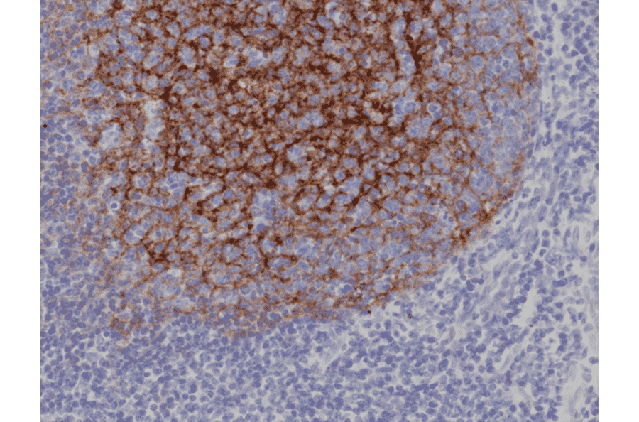 Immunohistochemistry - Anti-CD21 Antibody [RM372] (A121491) - Antibodies.com