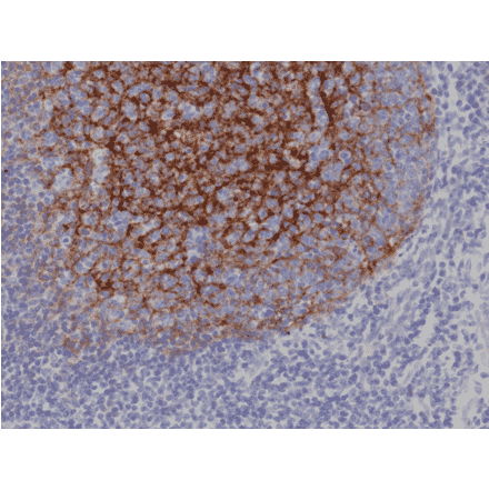Immunohistochemistry - Anti-CD21 Antibody [RM372] (A121491) - Antibodies.com