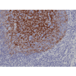 Immunohistochemistry - Anti-CD21 Antibody [RM372] (A121491) - Antibodies.com