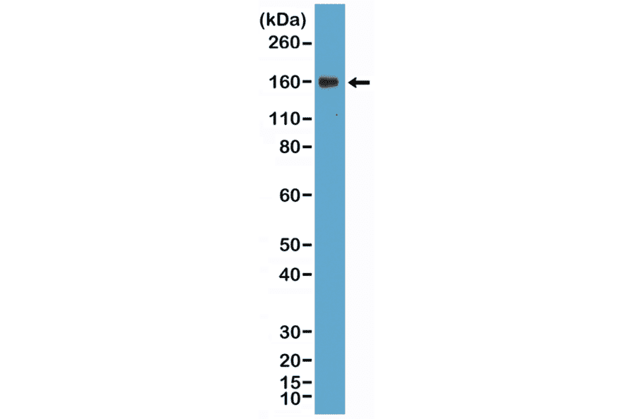 Western Blot - Anti-CD21 Antibody [RM372] (A121489) - Antibodies.com