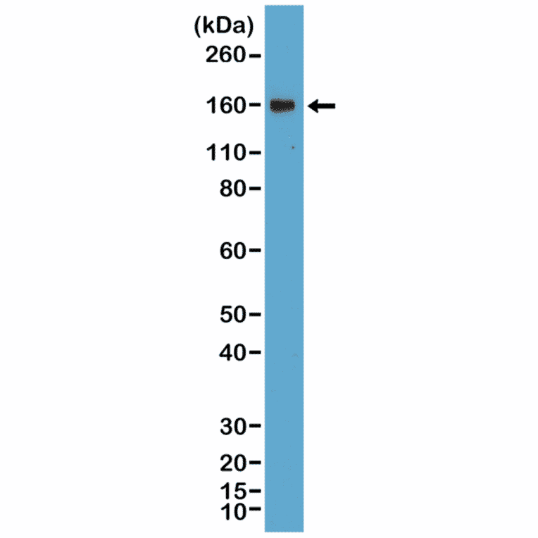 Western Blot - Anti-CD21 Antibody [RM372] (A121489) - Antibodies.com
