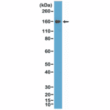 Western Blot - Anti-CD21 Antibody [RM372] (A121489) - Antibodies.com