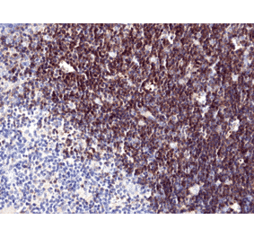 Immunohistochemistry - Anti-CD1a Antibody [RM393] (A121490) - Antibodies.com