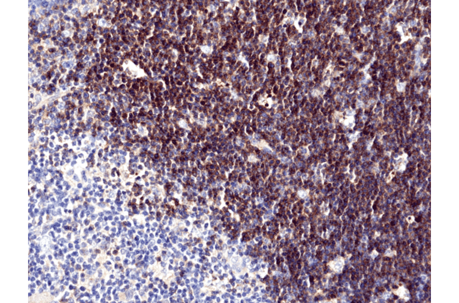 Immunohistochemistry - Anti-CD1a Antibody [RM393] (A121490) - Antibodies.com
