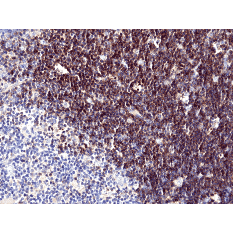 Immunohistochemistry - Anti-CD1a Antibody [RM393] (A121490) - Antibodies.com