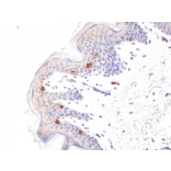 Immunohistochemistry - Anti-CD1a Antibody [RM393] (A121444) - Antibodies.com