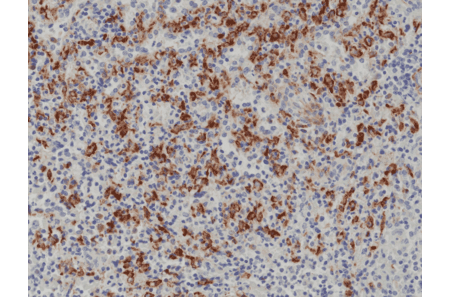 Immunohistochemistry - Anti-CD163 Antibody [RM371] (A121437) - Antibodies.com