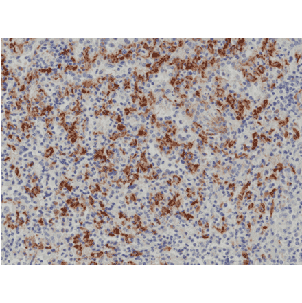Immunohistochemistry - Anti-CD163 Antibody [RM371] (A121437) - Antibodies.com