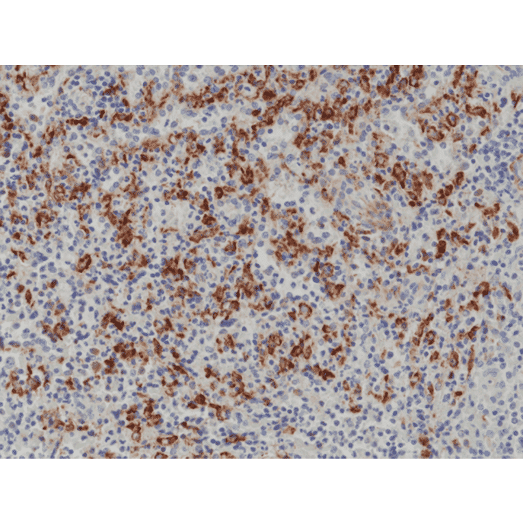 Immunohistochemistry - Anti-CD163 Antibody [RM371] (A121437) - Antibodies.com