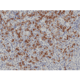 Immunohistochemistry - Anti-CD163 Antibody [RM371] (A121437) - Antibodies.com