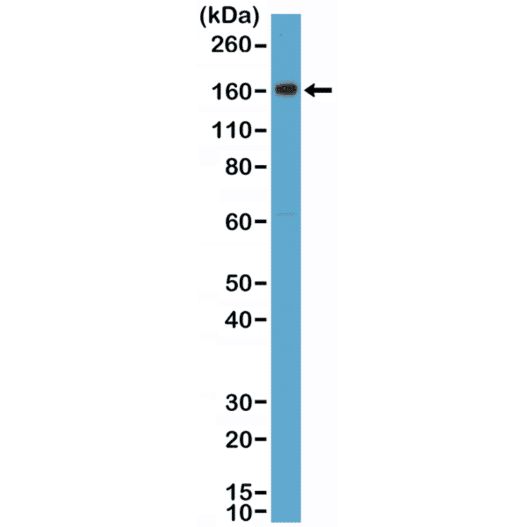 Western Blot - Anti-CD163 Antibody [RM371] (A121491) - Antibodies.com