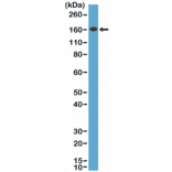 Western Blot - Anti-CD163 Antibody [RM371] (A121491) - Antibodies.com