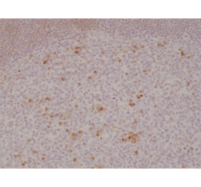 Immunohistochemistry - Anti-CD134 Antibody [RM313] (A121385) - Antibodies.com