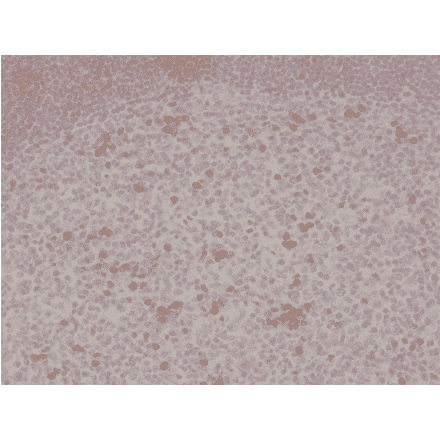 Immunohistochemistry - Anti-CD134 Antibody [RM313] (A121385) - Antibodies.com