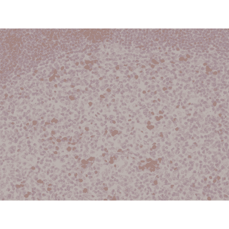 Immunohistochemistry - Anti-CD134 Antibody [RM313] (A121385) - Antibodies.com