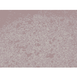 Immunohistochemistry - Anti-CD134 Antibody [RM313] (A121385) - Antibodies.com