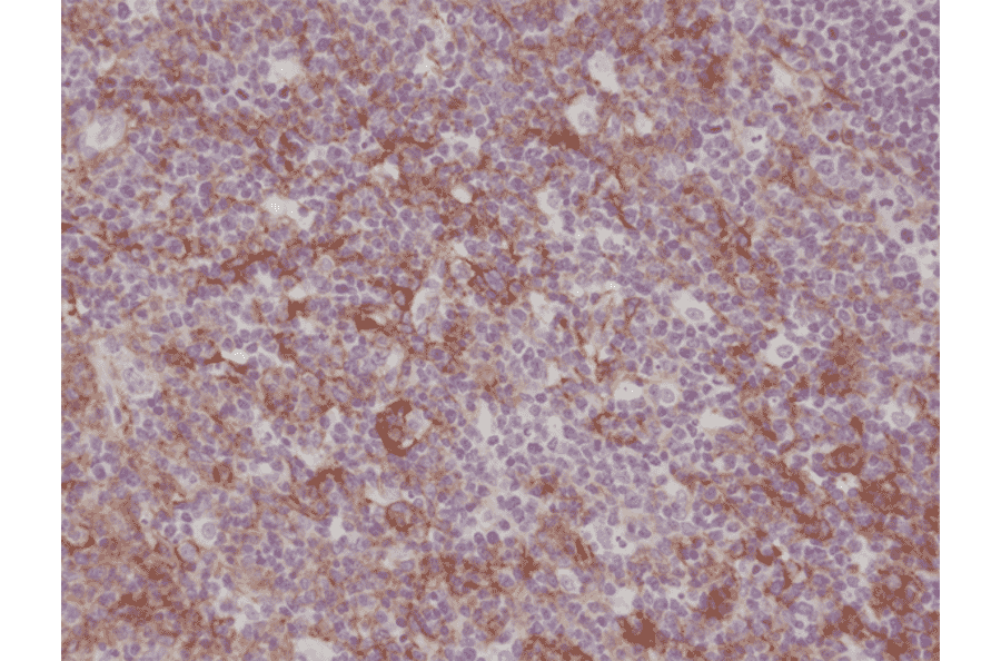 Immunohistochemistry - Anti-CD11b Antibody [RM290] (A121374) - Antibodies.com