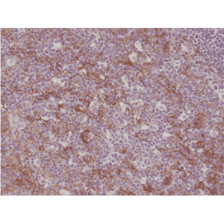 Immunohistochemistry - Anti-CD11b Antibody [RM290] (A121374) - Antibodies.com