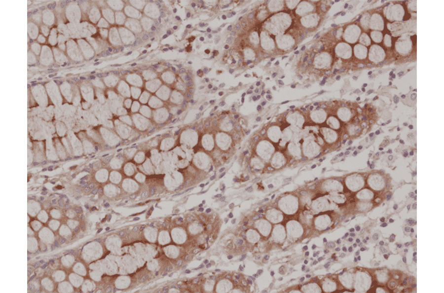 Immunohistochemistry - Anti-Carcino Embryonic Antigen Antibody [RM326] (A121494) - Antibodies.com
