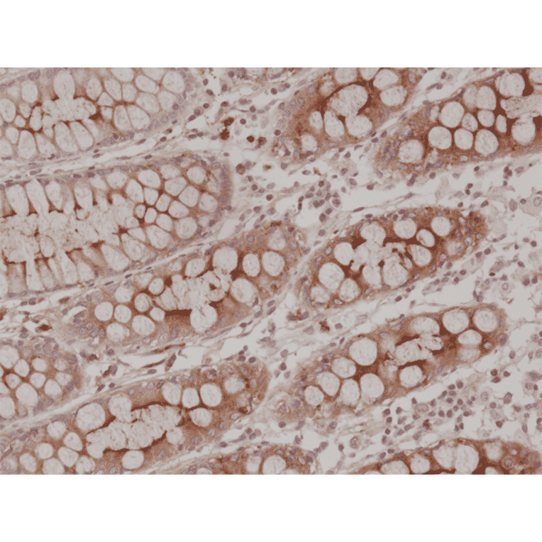 Immunohistochemistry - Anti-Carcino Embryonic Antigen Antibody [RM326] (A121494) - Antibodies.com