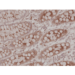 Immunohistochemistry - Anti-Carcino Embryonic Antigen Antibody [RM326] (A121494) - Antibodies.com