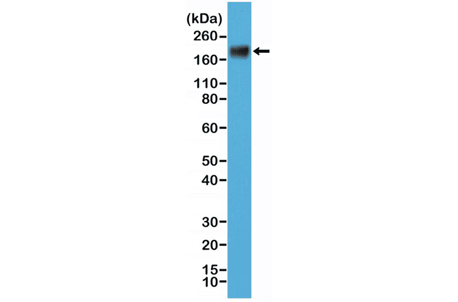 Western Blot - Anti-Carcino Embryonic Antigen Antibody [RM326] (A121495) - Antibodies.com