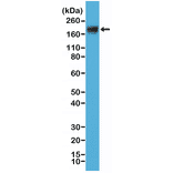 Western Blot - Anti-Carcino Embryonic Antigen Antibody [RM326] (A121495) - Antibodies.com