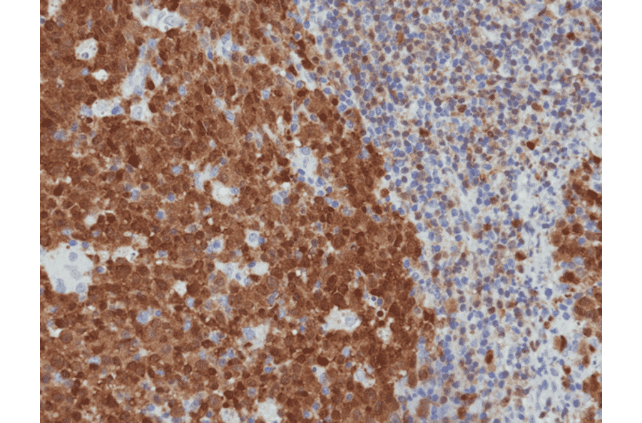 Immunohistochemistry - Anti-BOB1 Antibody [RM378] (A121499) - Antibodies.com