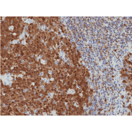 Immunohistochemistry - Anti-BOB1 Antibody [RM378] (A121499) - Antibodies.com