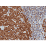 Immunohistochemistry - Anti-BOB1 Antibody [RM378] (A121499) - Antibodies.com