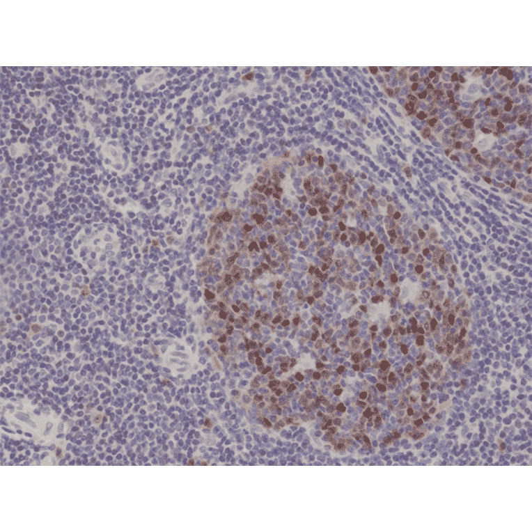 Immunohistochemistry - Anti-Aurora B Antibody [RM278] (A121378) - Antibodies.com