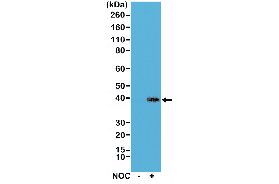 Western Blot - Anti-Aurora B Antibody [RM278] (A121498) - Antibodies.com