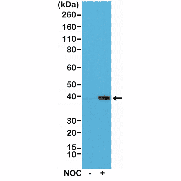 Western Blot - Anti-Aurora B Antibody [RM278] (A121498) - Antibodies.com