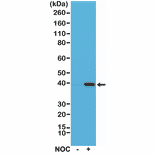 Western Blot - Anti-Aurora B Antibody [RM278] (A121498) - Antibodies.com