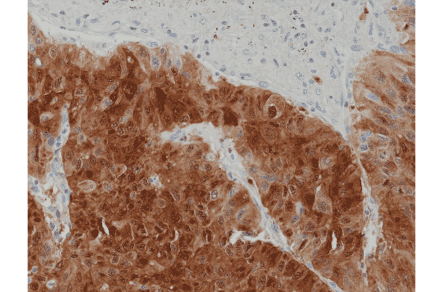 Immunohistochemistry - Anti-Arginase Antibody [RM377] (A121461) - Antibodies.com
