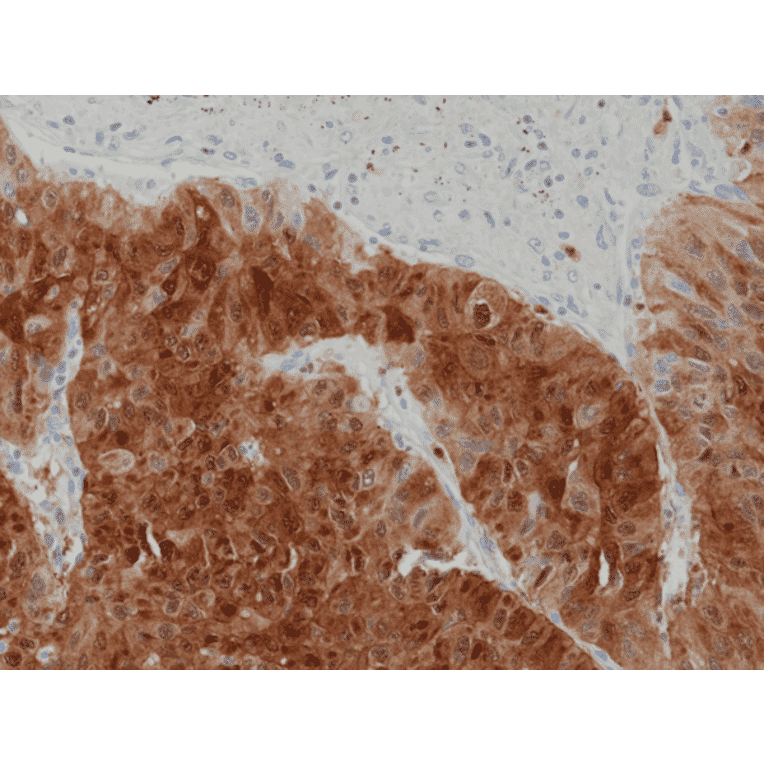 Immunohistochemistry - Anti-Arginase Antibody [RM377] (A121461) - Antibodies.com