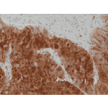Immunohistochemistry - Anti-Arginase Antibody [RM377] (A121461) - Antibodies.com