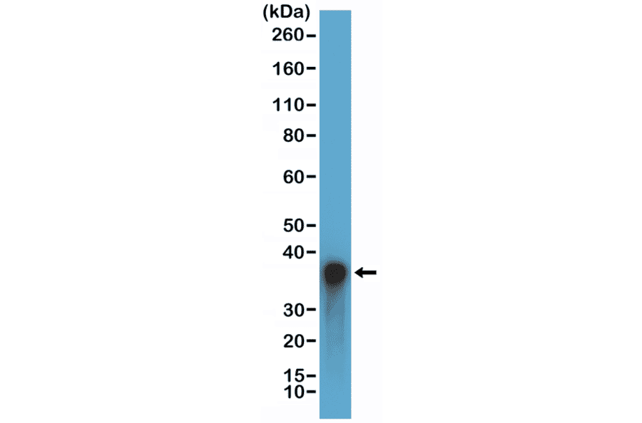 Western Blot - Anti-Arginase Antibody [RM377] (A121499) - Antibodies.com
