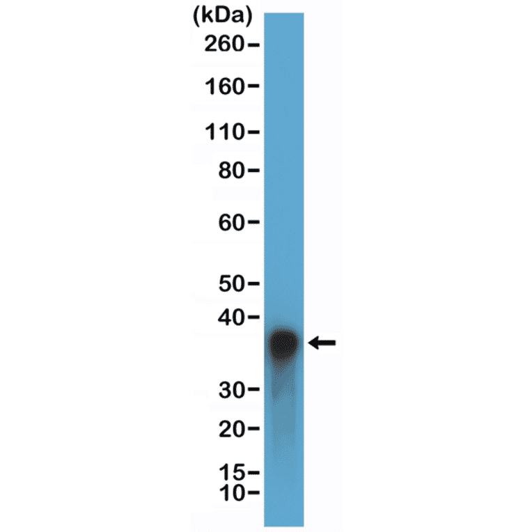 Western Blot - Anti-Arginase Antibody [RM377] (A121499) - Antibodies.com