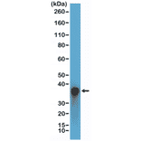Western Blot - Anti-Arginase Antibody [RM377] (A121499) - Antibodies.com