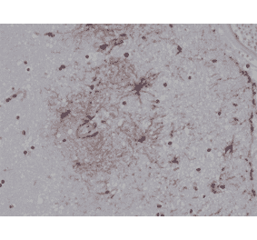 Immunohistochemistry - Anti-GFAP Antibody [RM246] (A121383) - Antibodies.com