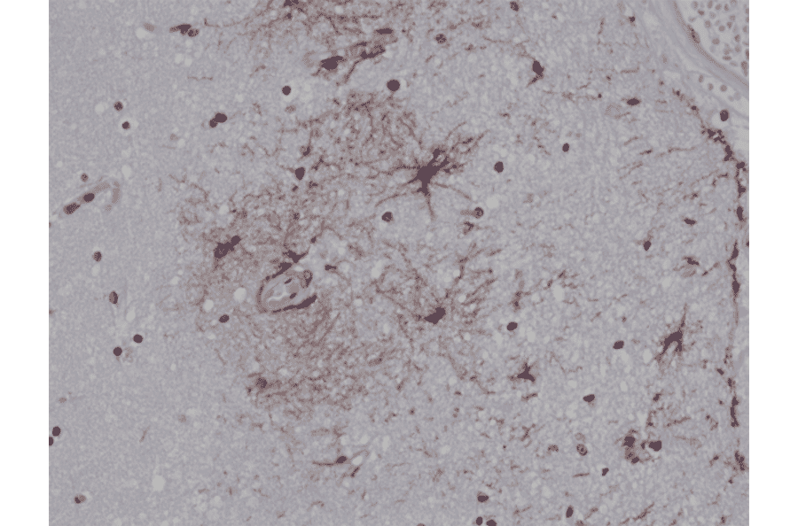 Immunohistochemistry - Anti-GFAP Antibody [RM246] (A121383) - Antibodies.com