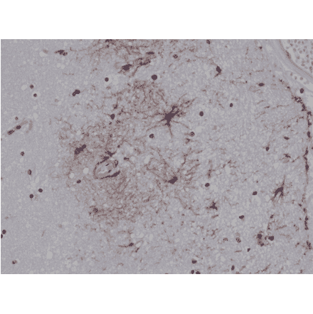 Immunohistochemistry - Anti-GFAP Antibody [RM246] (A121383) - Antibodies.com