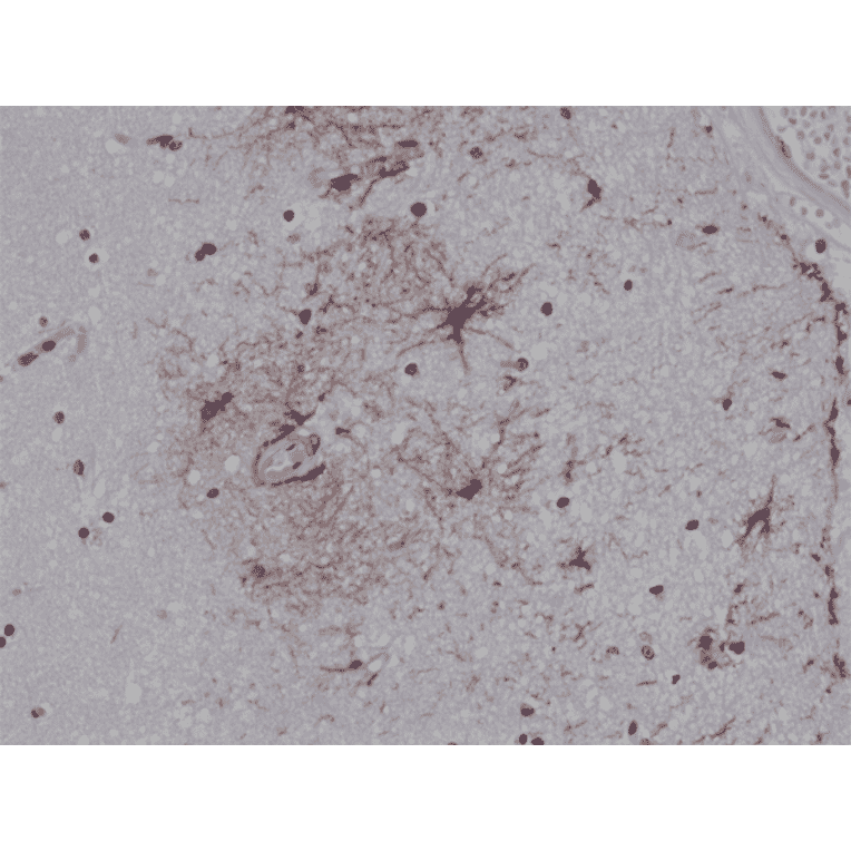 Immunohistochemistry - Anti-GFAP Antibody [RM246] (A121383) - Antibodies.com