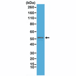 Western Blot - Anti-GFAP Antibody [RM246] (A121500) - Antibodies.com
