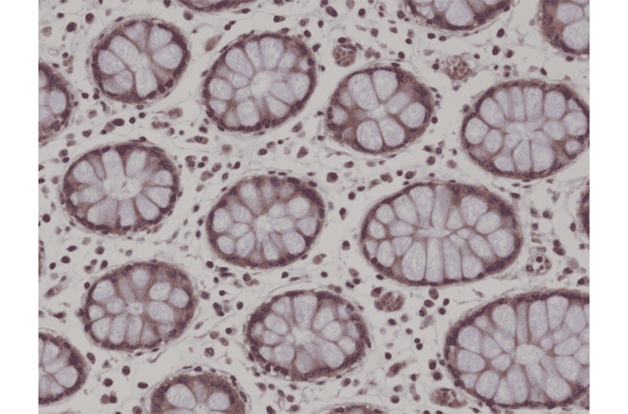 Immunohistochemistry - Anti-AMPK alpha 1 Antibody [RM301] (A121420) - Antibodies.com