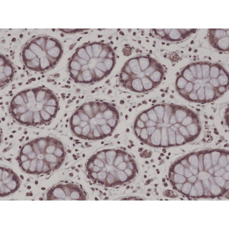 Immunohistochemistry - Anti-AMPK alpha 1 Antibody [RM301] (A121420) - Antibodies.com