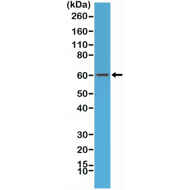 Western Blot - Anti-AMPK alpha 1 Antibody [RM301] (A121501) - Antibodies.com