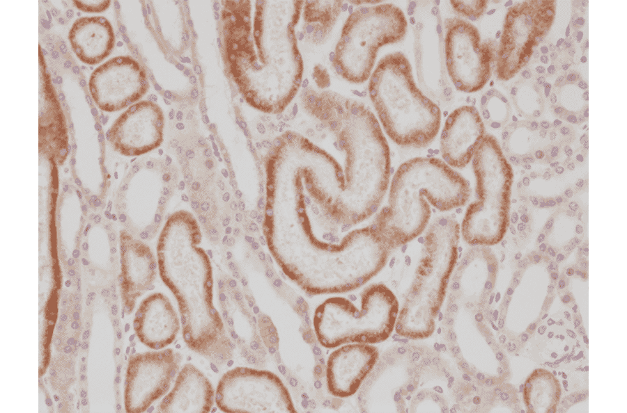 Immunohistochemistry - Anti-AMACR Antibody [RM349] (A121475) - Antibodies.com